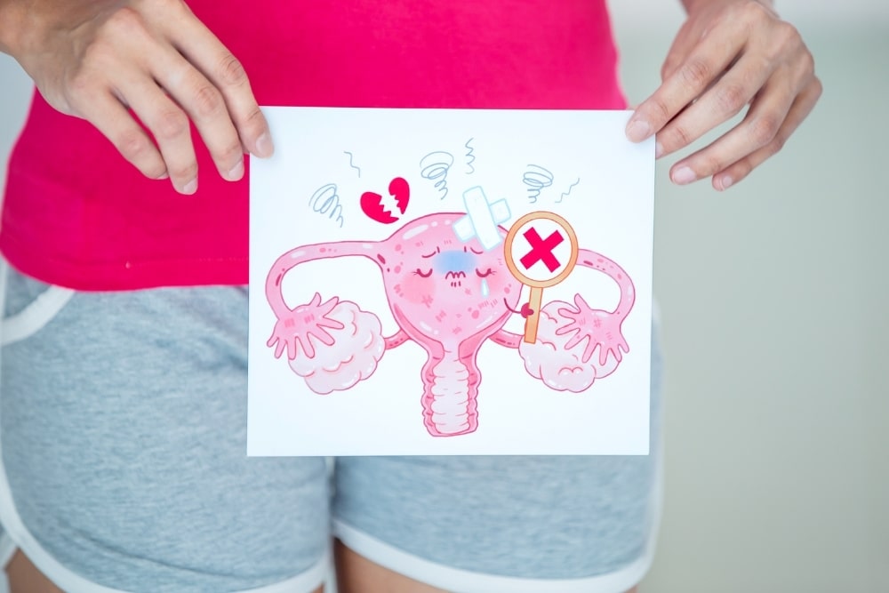 woman holding an illustration of a woman’s reproductive area