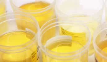 bright yellow urine