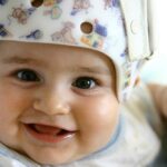 Why Do Babies Wear Helmets?