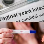 Is A Yeast Infection After Ovulation A Sign Of Pregnancy?