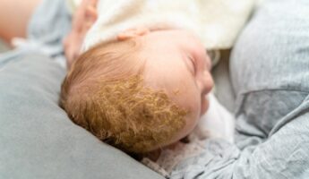 Does Cradle Cap Smell? Why Does My Babies Head Smell So Bad?