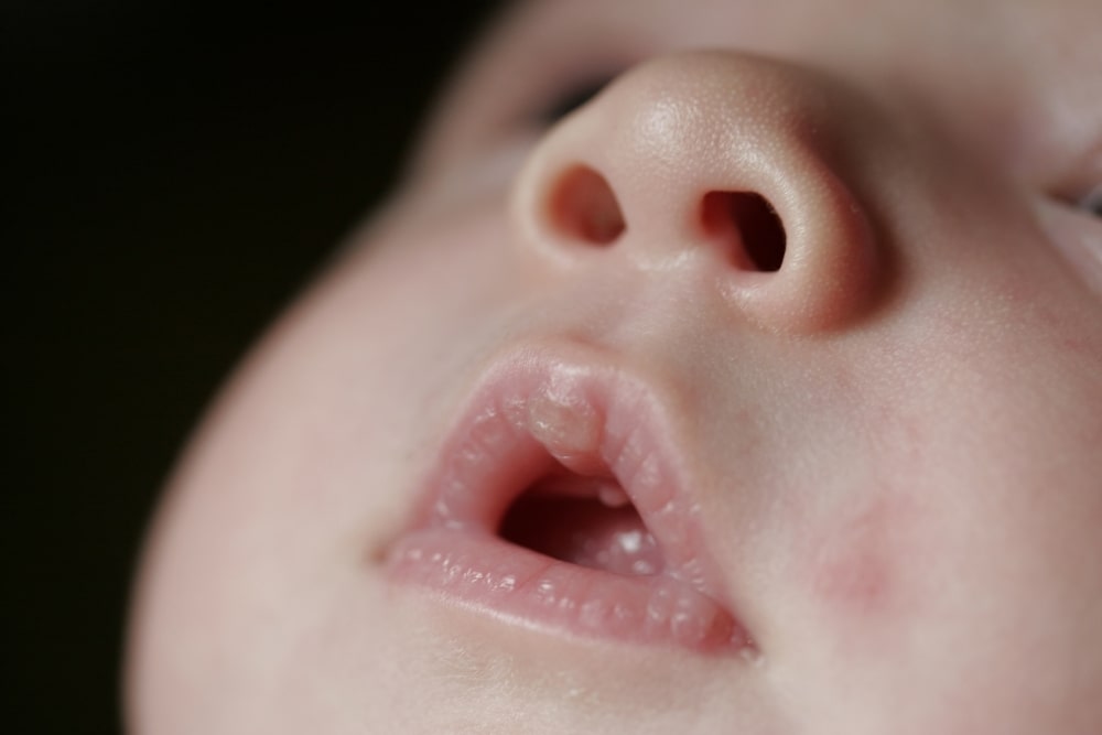 baby open mouth (2)